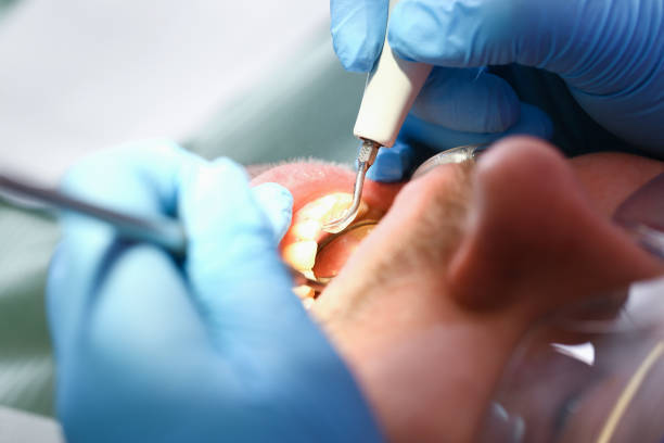 Best Emergency Treatment for Dental Infections or Abscesses in Ixonia, WI