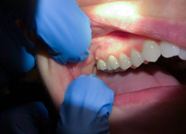 Best Weekend Emergency Dentist in Ixonia, WI
